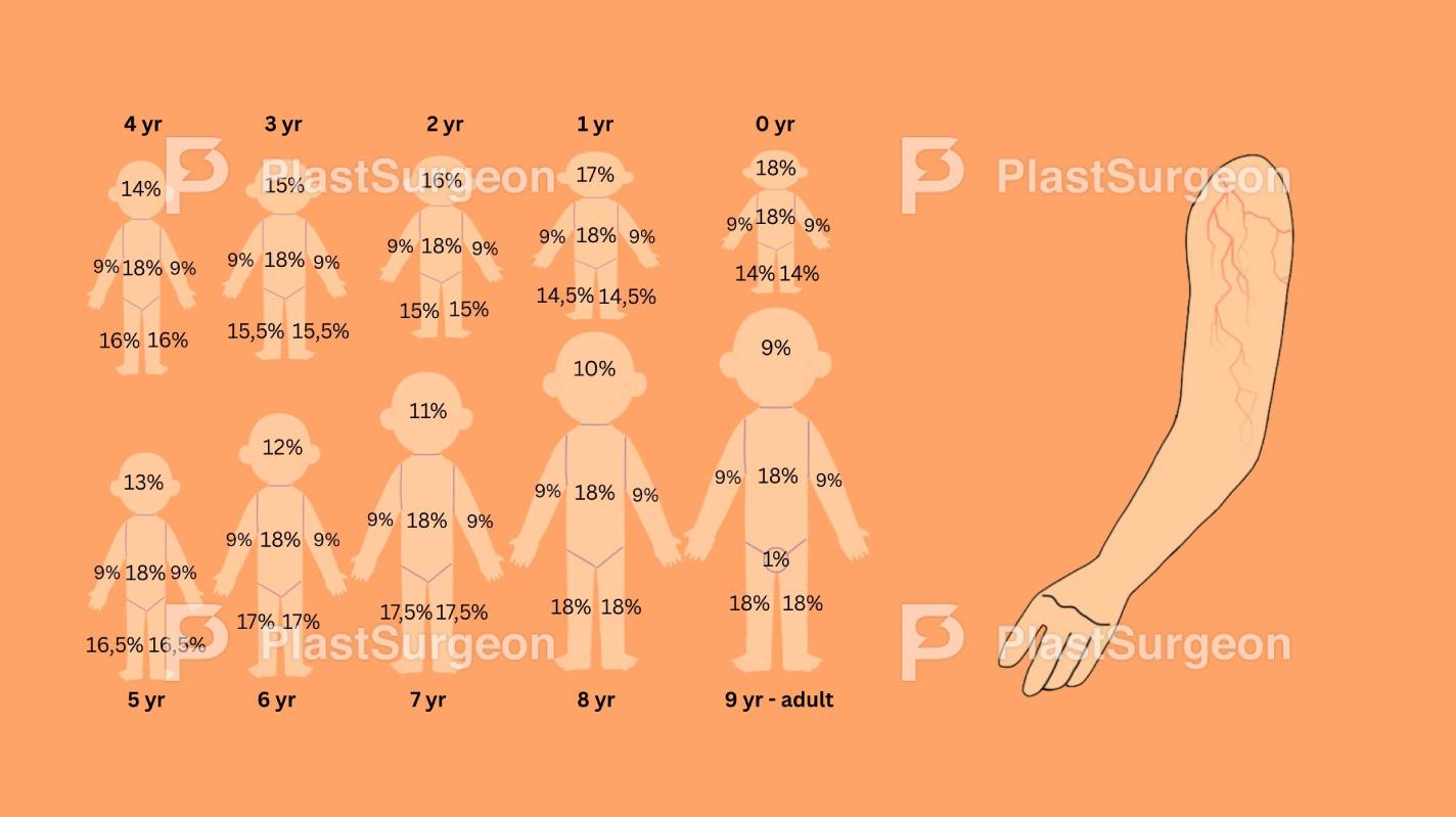 Burns – Paediatric Burns and Electrical Burns